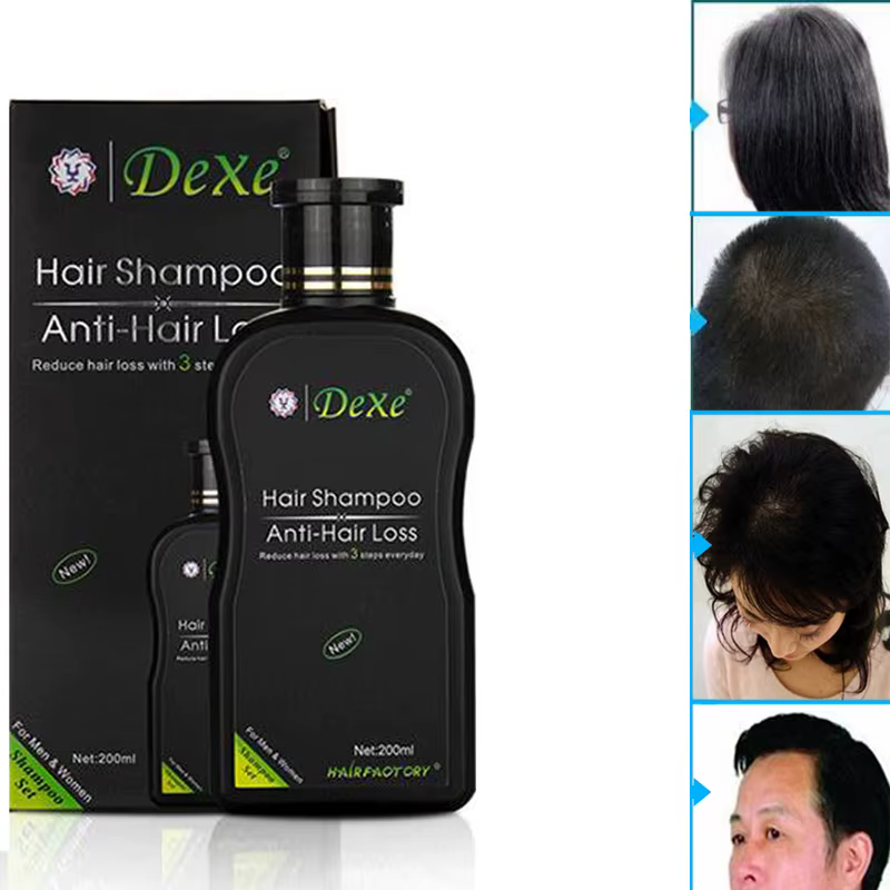 Ensemble de shampoing pour cheveux, 200ml, Anti-chute, produit chinois pour la croissance des cheveu