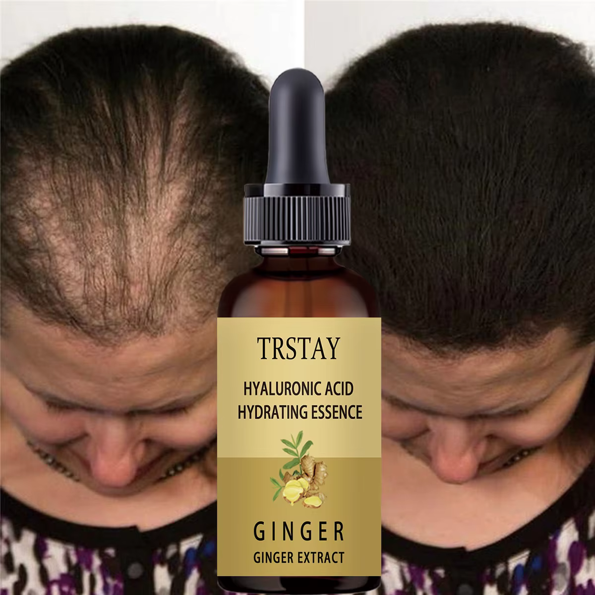 Sérum de croissance des cheveux, Anti-chute, liquide d'alopécie, réparation des cheveux endommagés,