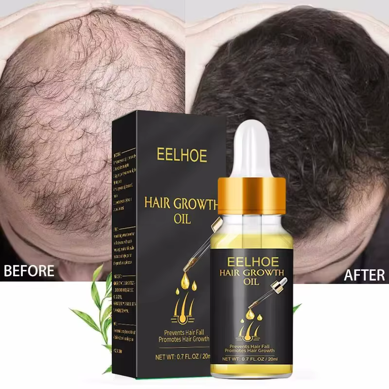Sérum de croissance rapide des cheveux, huile essentielle Anti-chute, réparation du cuir chevelu end