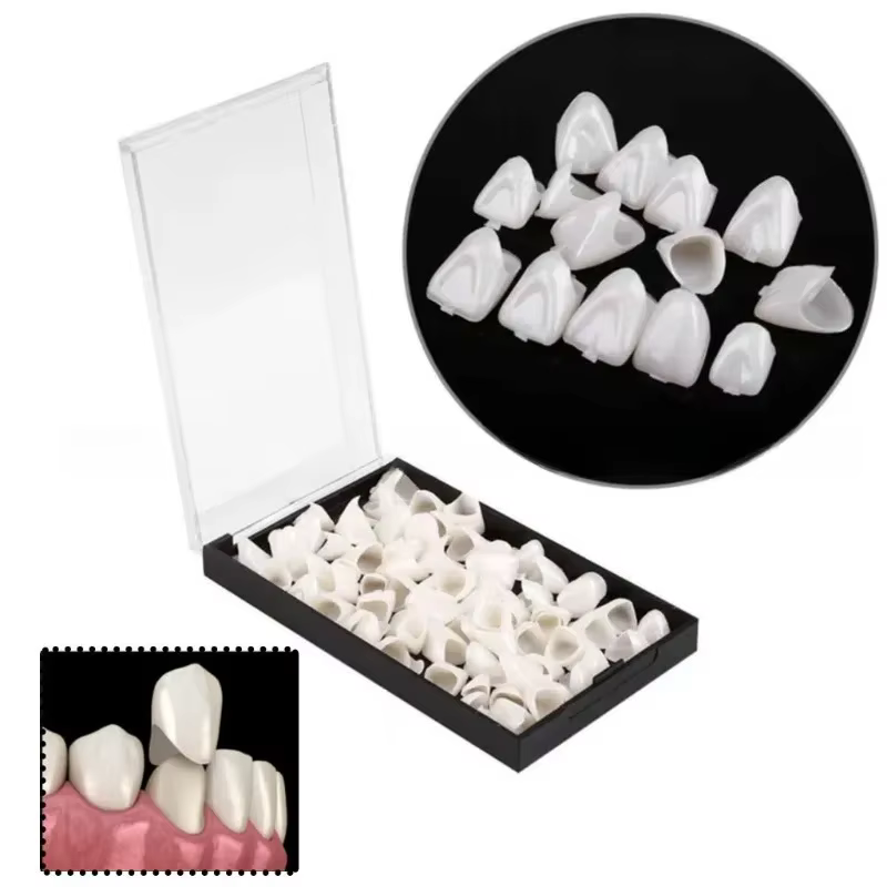 Nouvelles 50/90 pièces/boîte pour soins bucco-dentaires (dents avant et dents arrière) - Facettes en