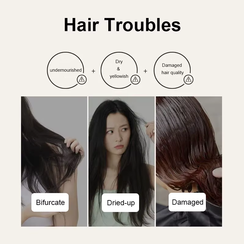 Zhangguang 101 revitalisant réparateur hydratant à base de plantes Anti-perte de cheveux produits de