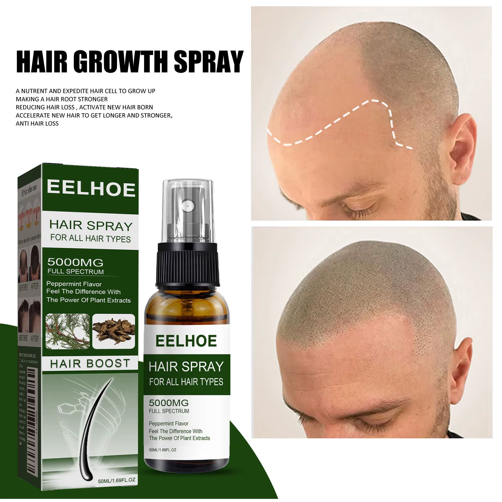 Spray anti-chute pour soins capillaires, cheveux épais, forts et beaux, anti-chute, raffermissant et