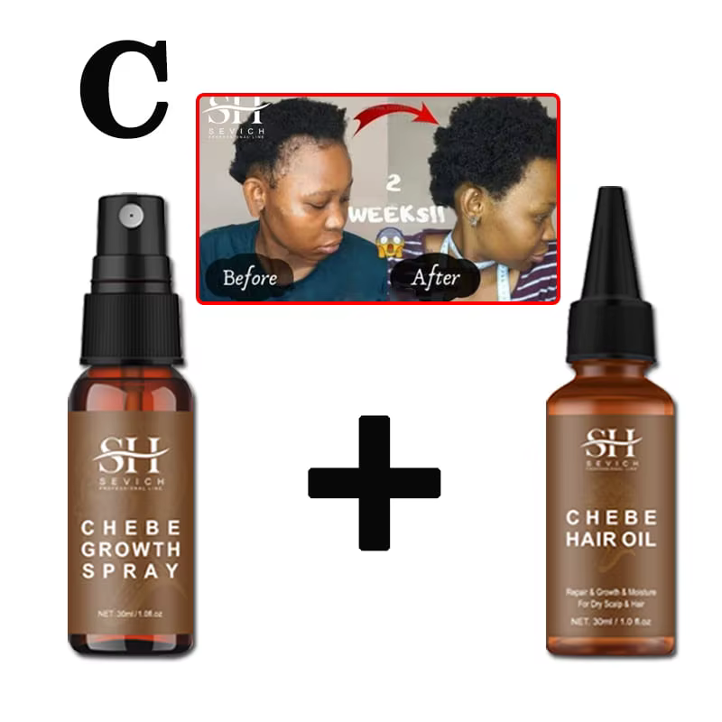 Sevich Chebe traitement de perte de cheveux Spray Traction Alopecia Chebe poudre huile essentielle a