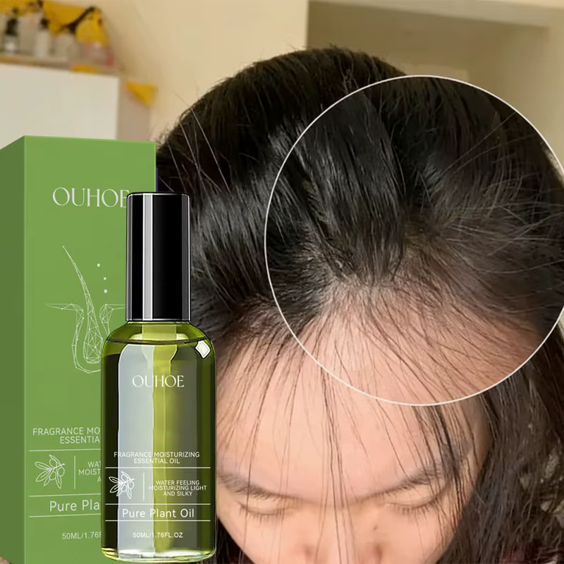 Sérum en spray pour la croissance rapide des cheveux, anti-chute, prévention de la calvitie, traitem
