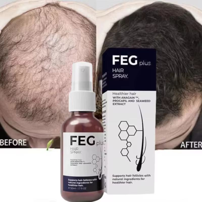 FEG-Huile de Soins Capillaires Biologique, pour Cheveux Longs, pour la Maison, Rotterdam y, 50ml