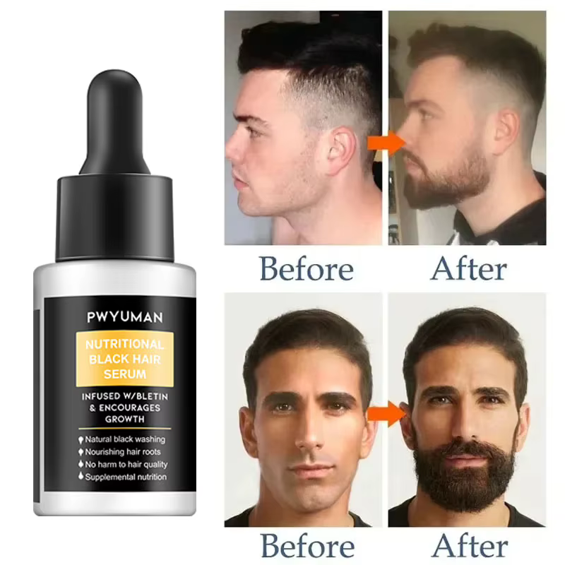 Sérum de croissance de barbe Spray, huile essentielle de croissance de cheveux, plus épais, plus épa