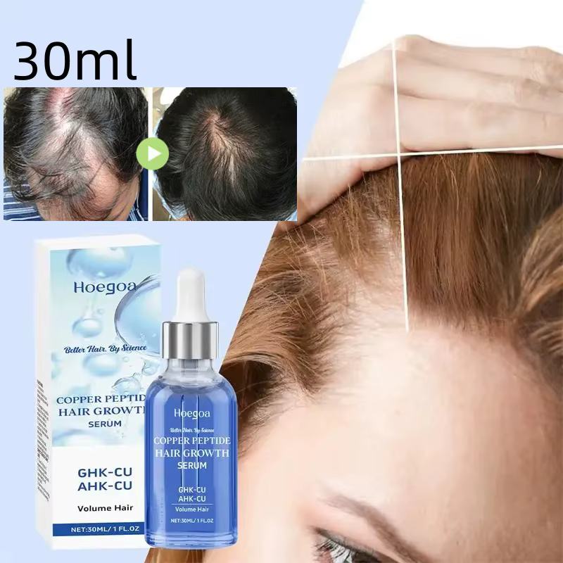 Sérum de croissance des cheveux, Anti-perte, huile de croissance des cheveux, prévient la calvitie,