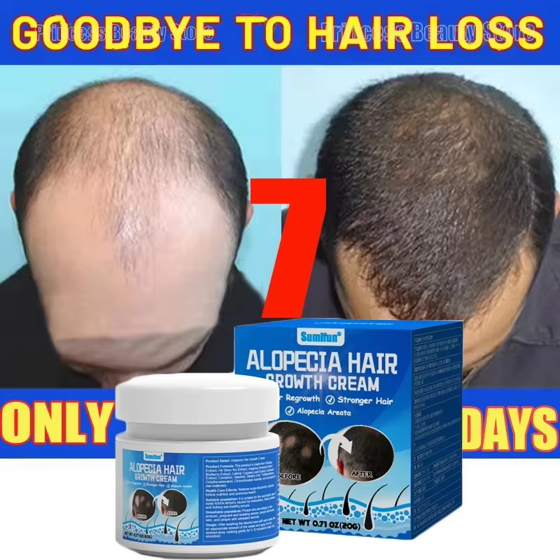 Crème pour la croissance des cheveux, repousse rapide en 7 jours, renforce les racines des cheveux,