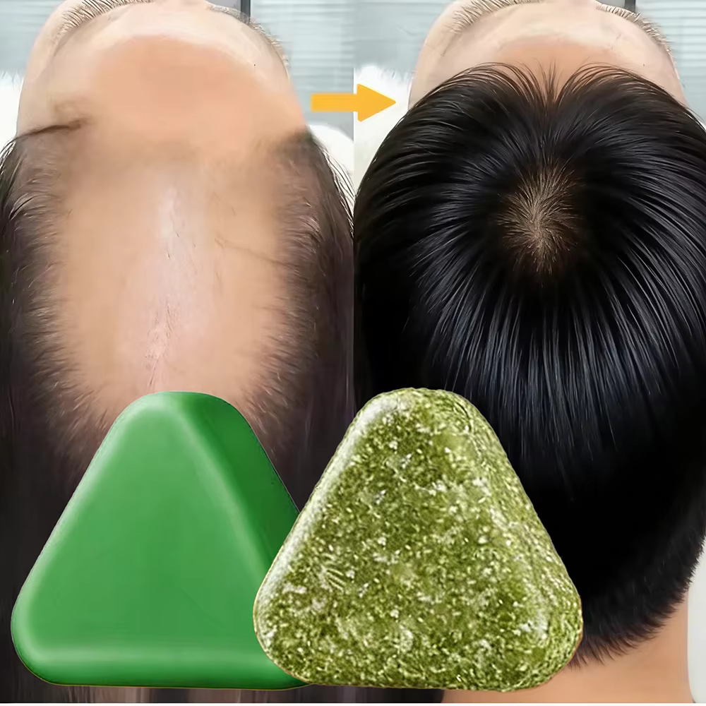 Shampoing à base de plantes naturelles, savon fait à la main, nourrissant, contrôle de l'huile, soin