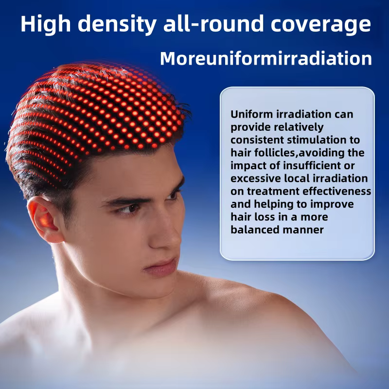 312 laser bonnet de cheveux chapeau pour cheveux growt casquette de thérapie par la lumière rouge ca