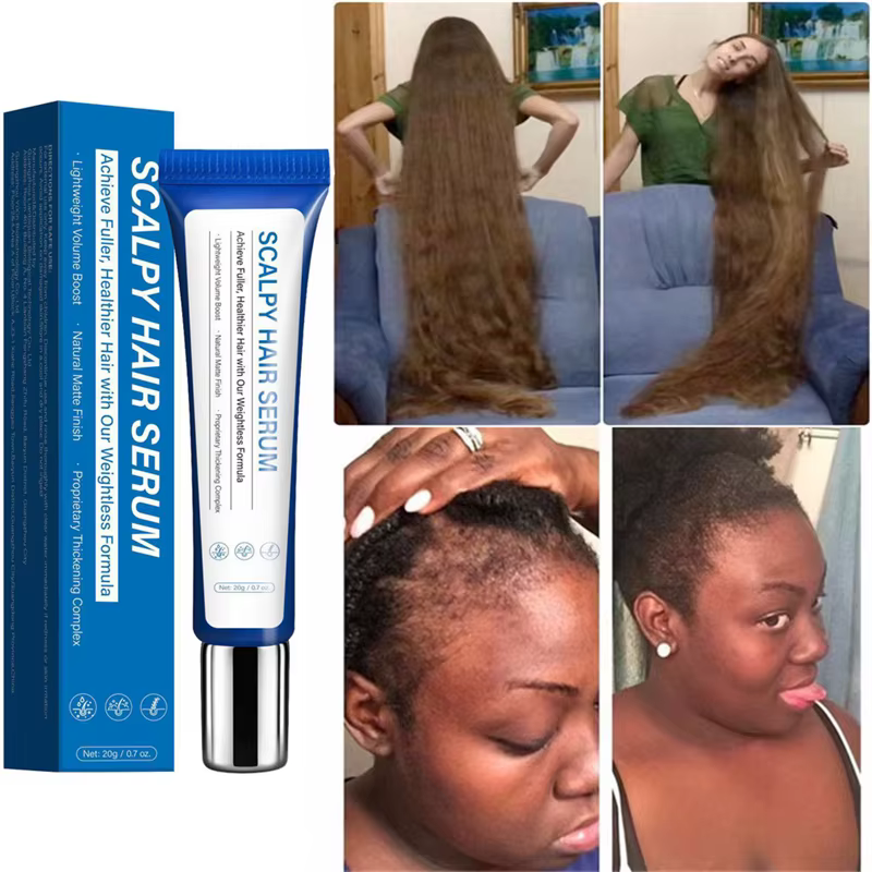 Sérum de croissance rapide des cheveux, huile essentielle Anti-chute, réparation du cuir chevelu end