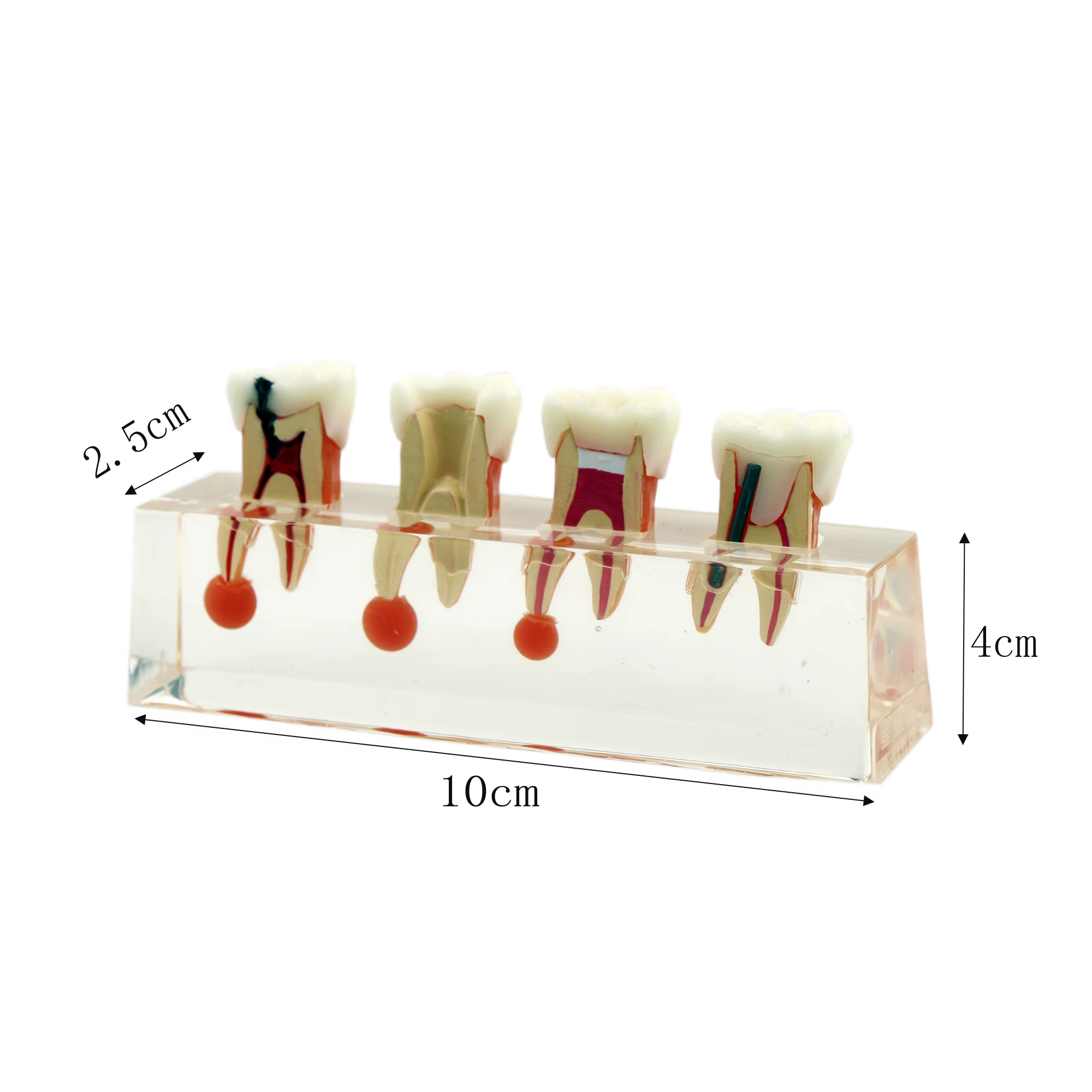 Modèle de dents dentaires transparentes, traitement endodontique en 4 étapes, modèle de démonstration pour l'étude, la décoration de clinique Fuchsia