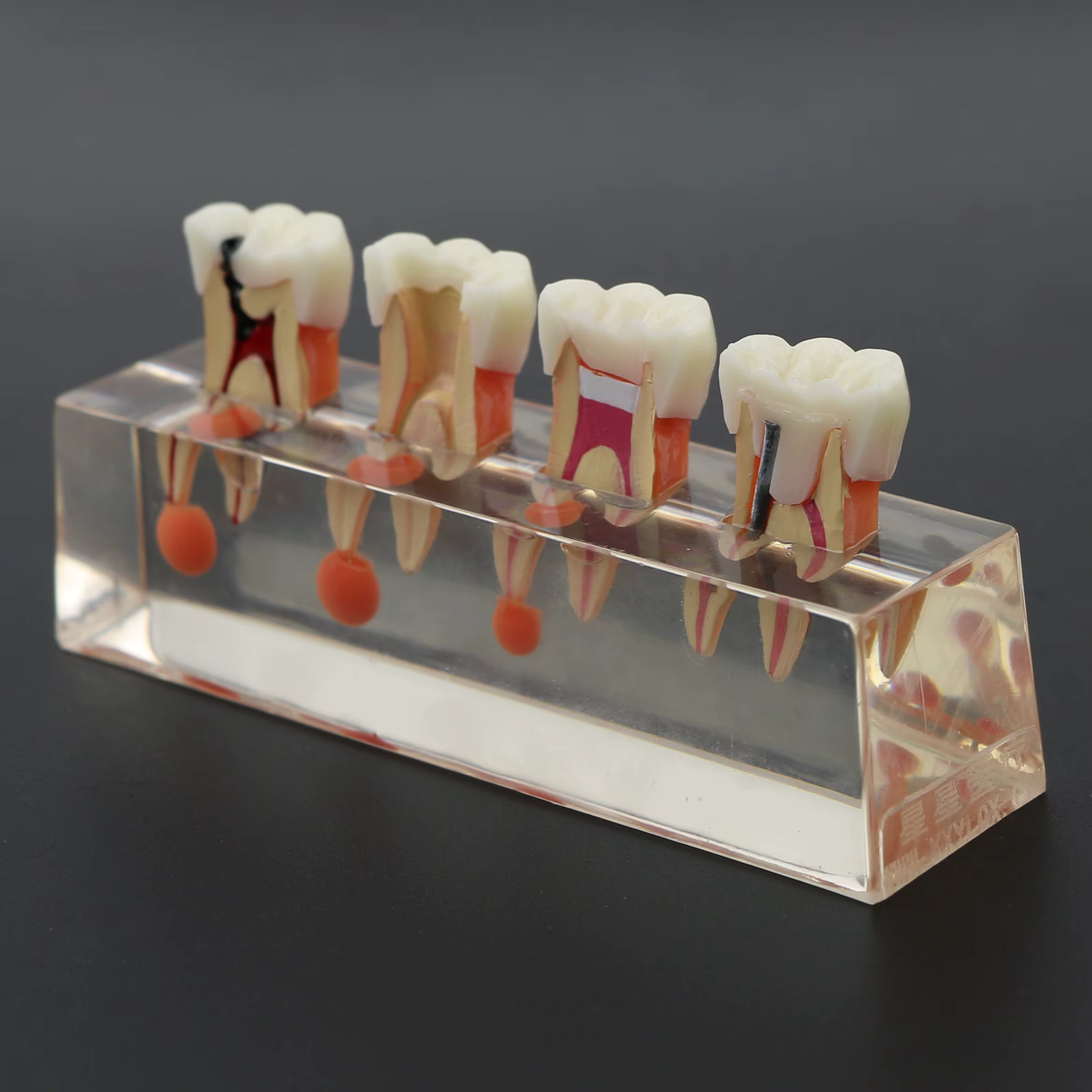 Modèle de dents dentaires transparentes, traitement endodontique en 4 étapes, modèle de démonstration pour l'étude, la décoration de clinique Fuchsia