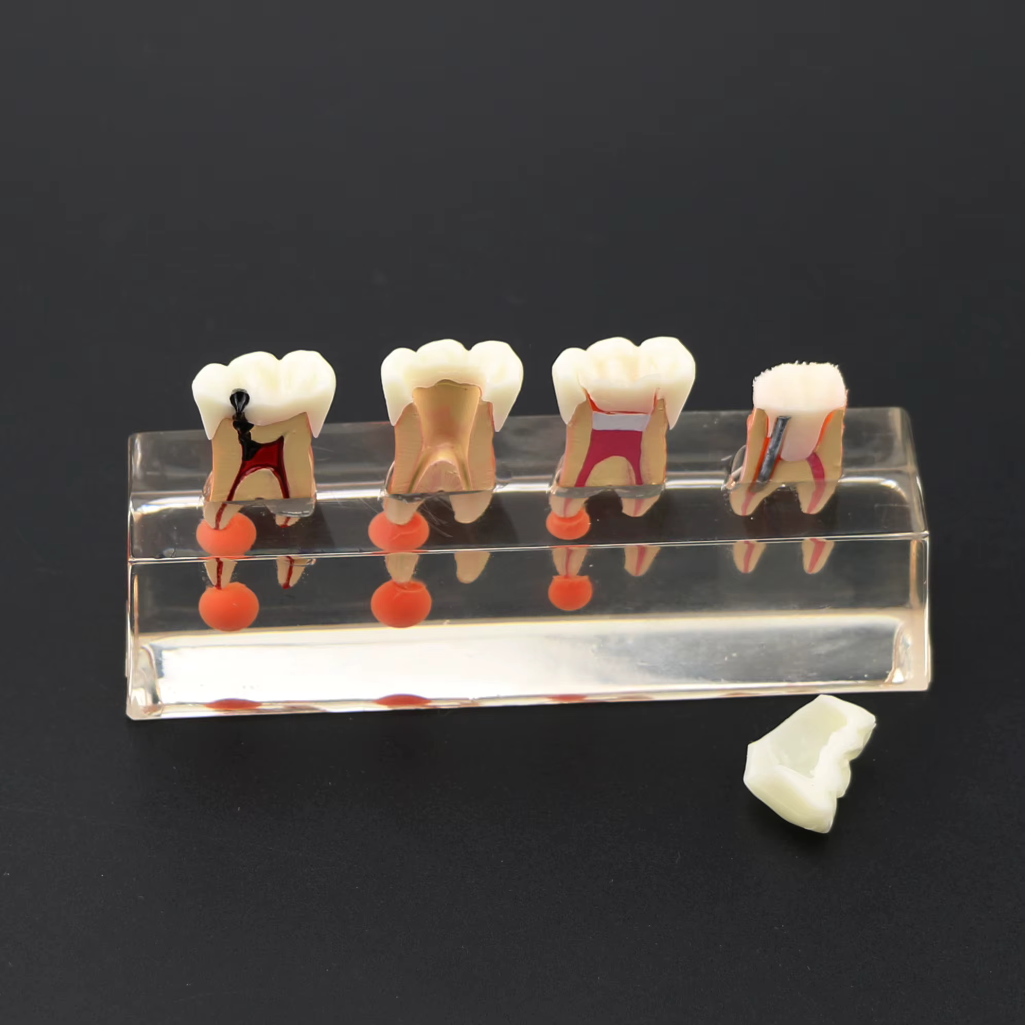 Modèle de dents dentaires transparentes, traitement endodontique en 4 étapes, modèle de démonstration pour l'étude, la décoration de clinique Fuchsia