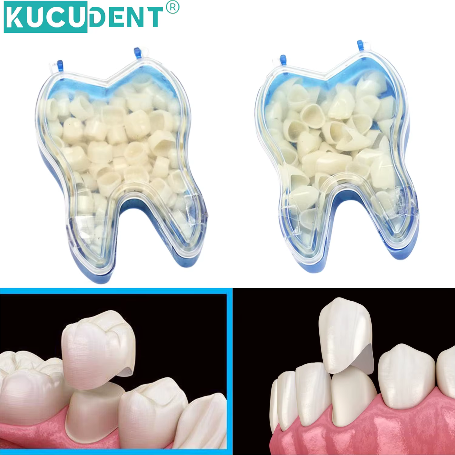 Kit de couronne dentaire temporaire, 50 pièces/boîte, placage de dents antérieures, molaire avant, postérieur, soins buccaux, blanchiment des dents, matériel de dentiste