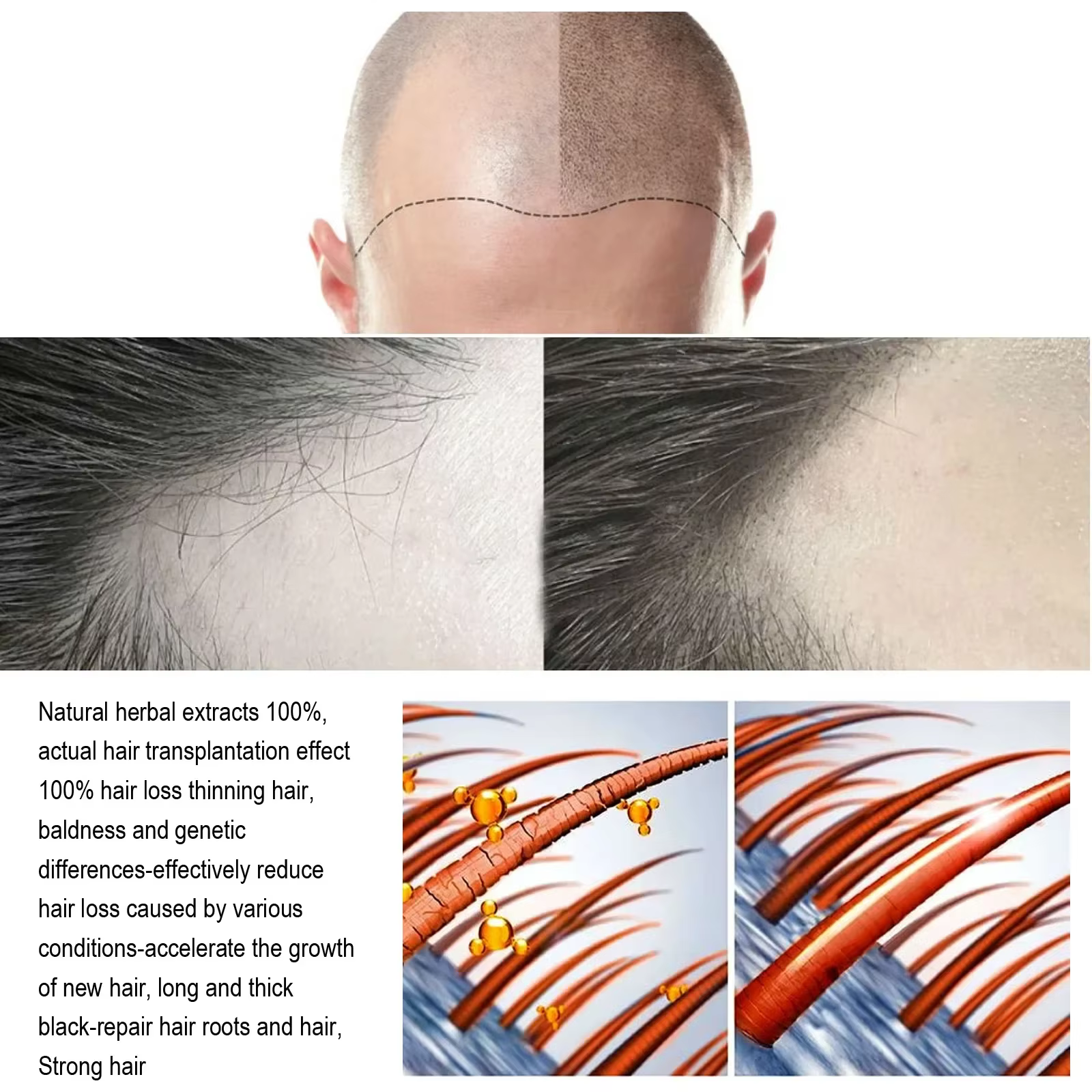 Huile essentielle de soin capillaire au gingembre naturel