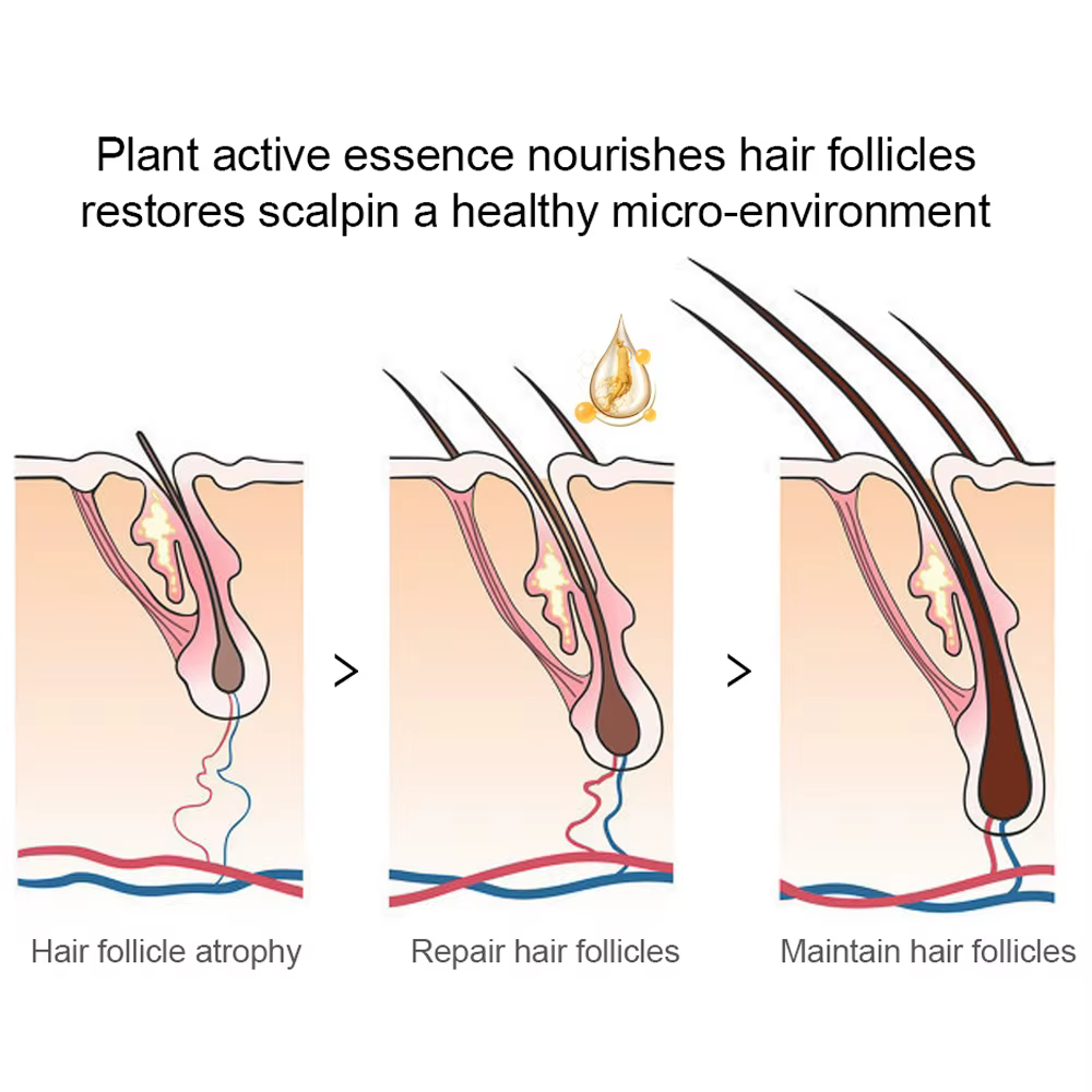 Huile de croissance de barbe puissante pour hommes
