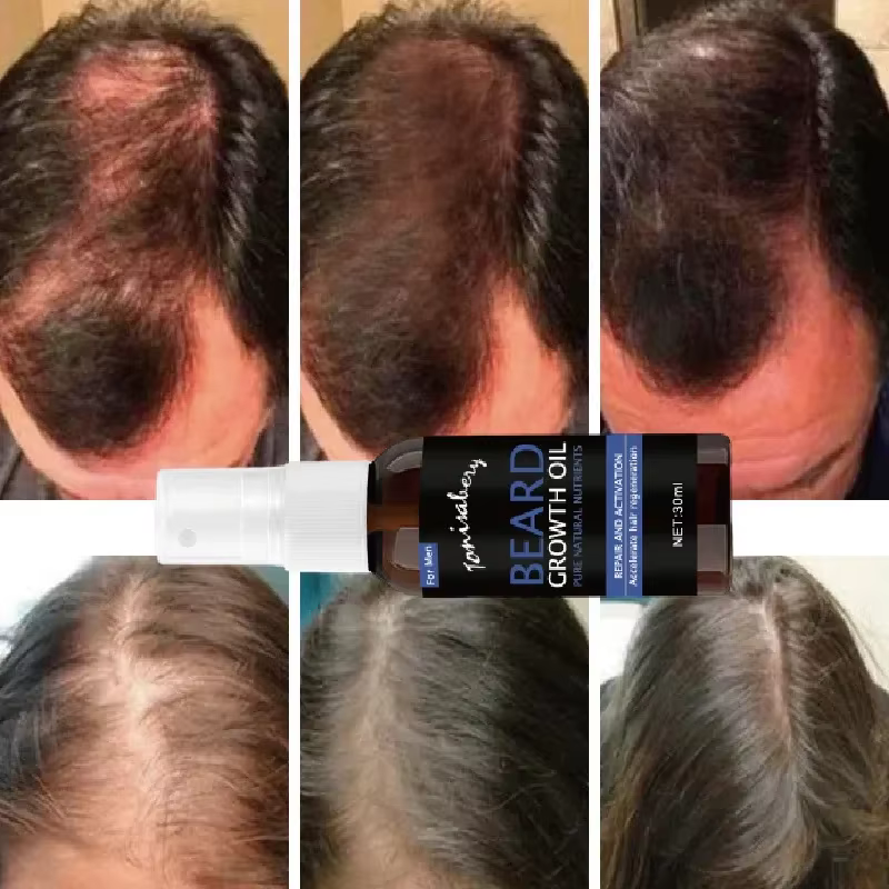 Sérum de croissance de barbe Spray