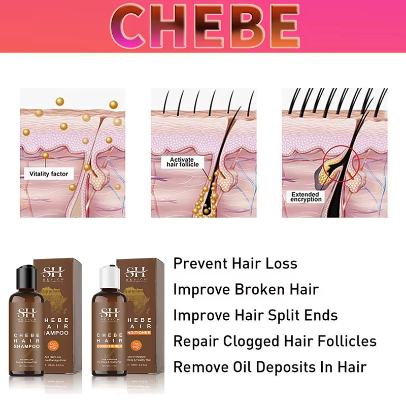 Sevich Chebe traitement de perte de cheveux Spray Traction Alopecia