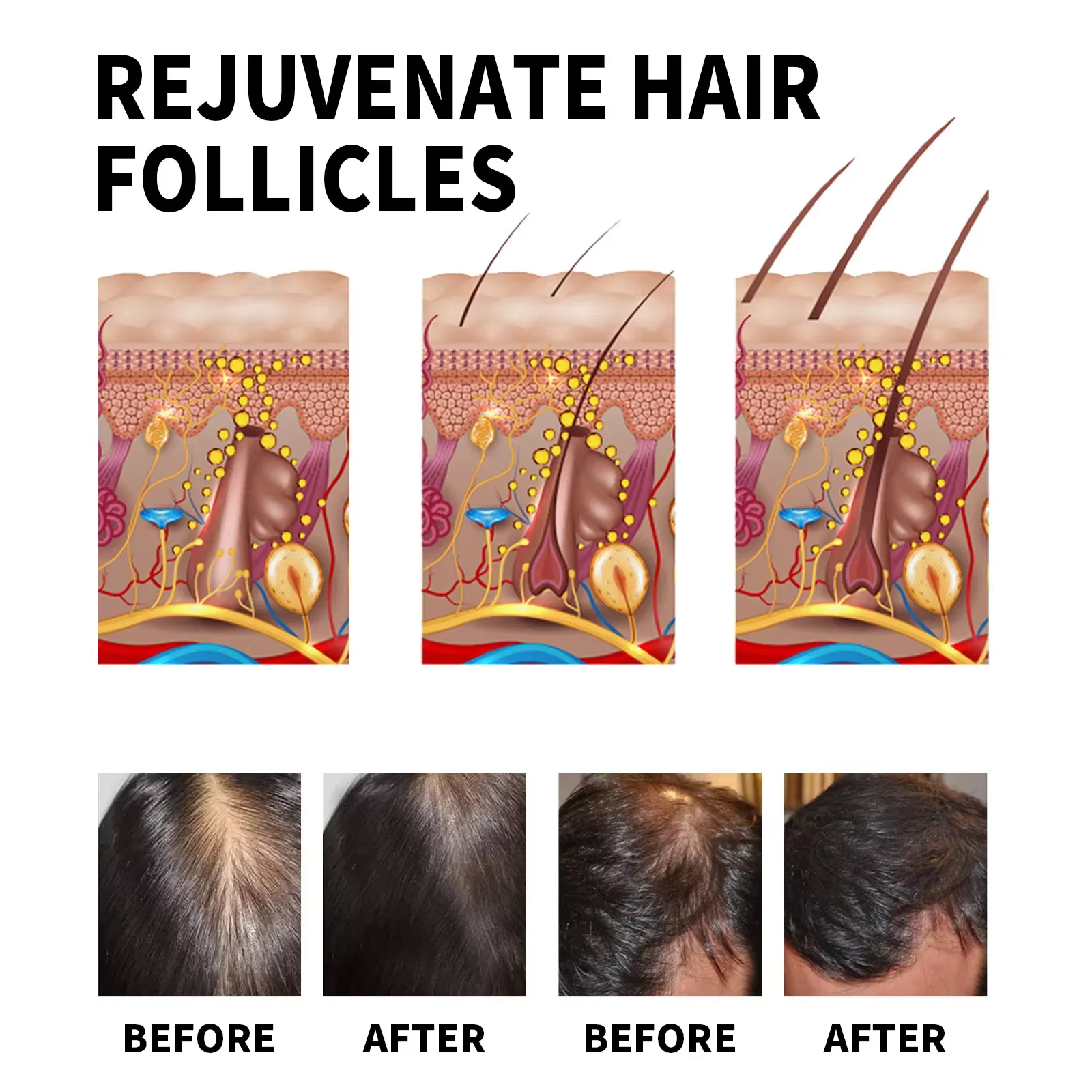 Produits de croissance des cheveux au gingembre huile essentielle