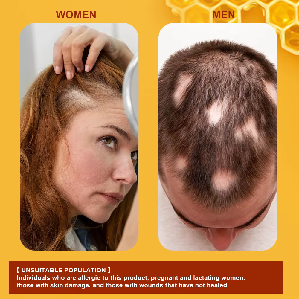 Crème de croissance des cheveux