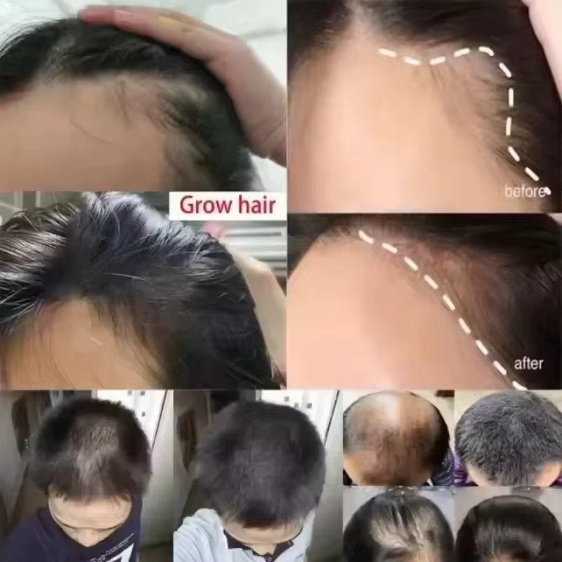 Crème de croissance des cheveux 7 jours