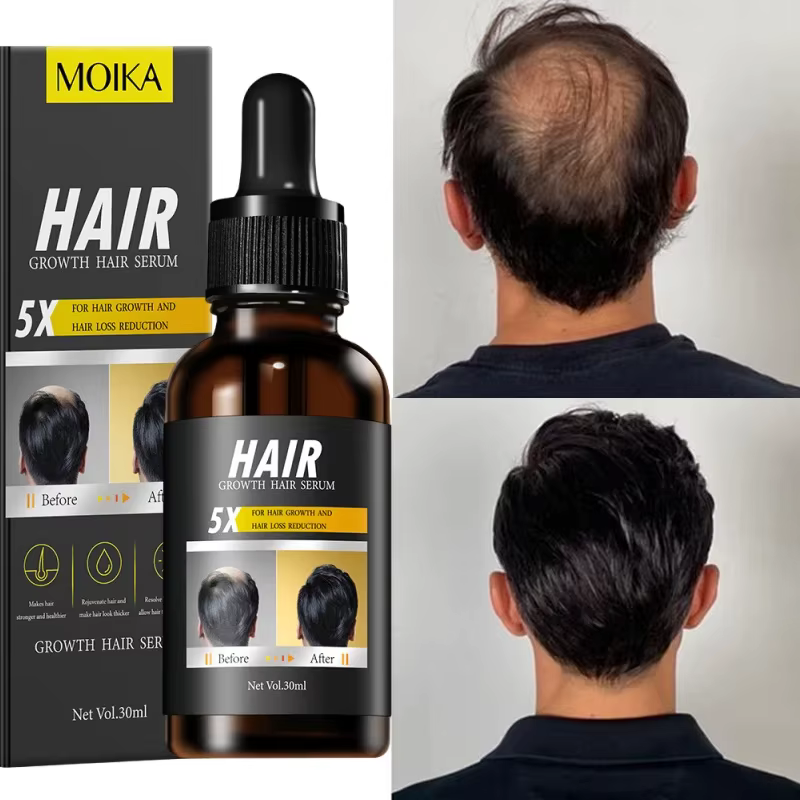Sérum de croissance rapide des cheveux