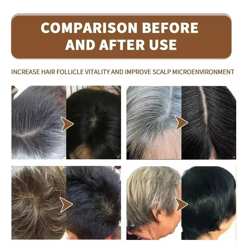 Sérum de traitement pour cheveux gris et blancs