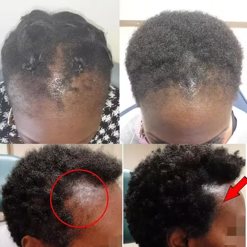 Kit de Croissance Capillaire Rapide : Huile de Batana