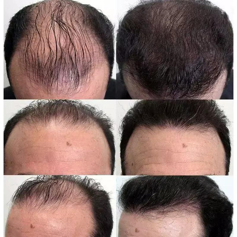 Sérum de croissance rapide des cheveux
