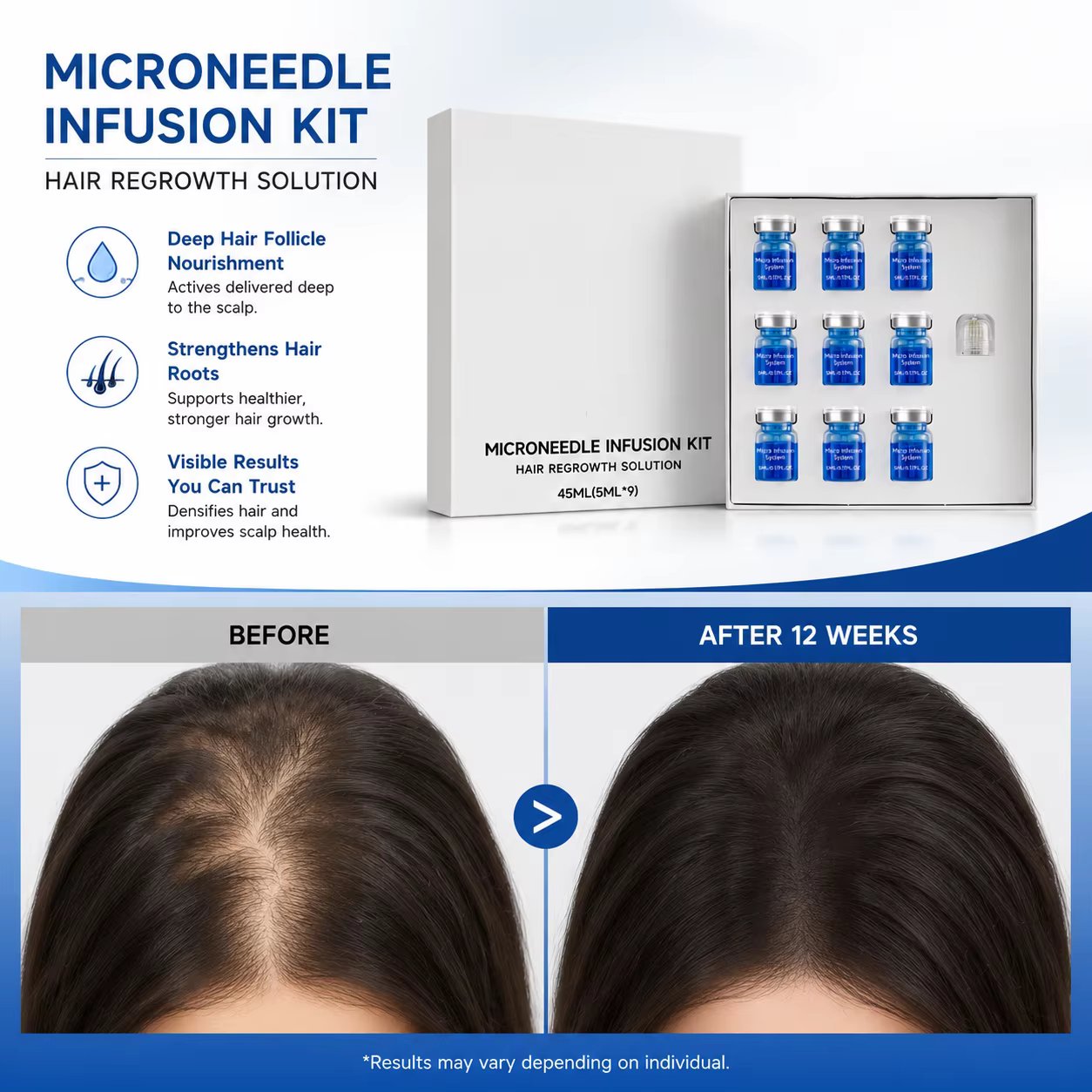 Kit de repousse des cheveux par micro-aiguilles