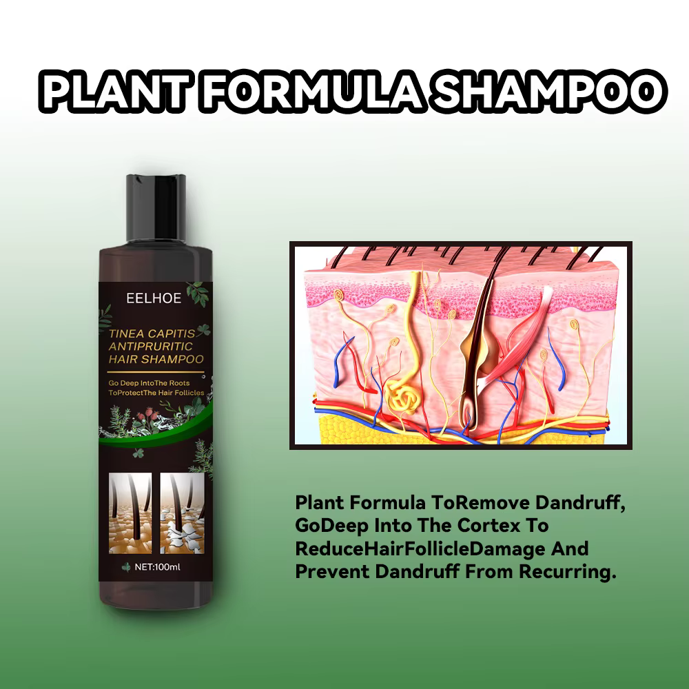 100ml Eelhoe shampooing Anti-démangeaisons