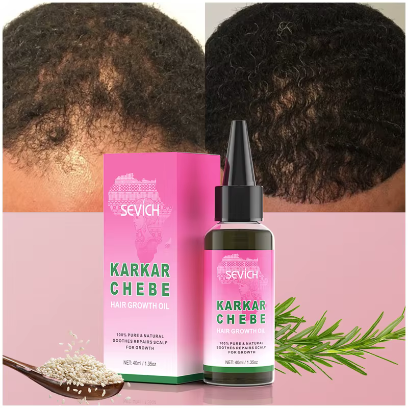 100% pur naturel Karkar Chebe huile Batana beurre