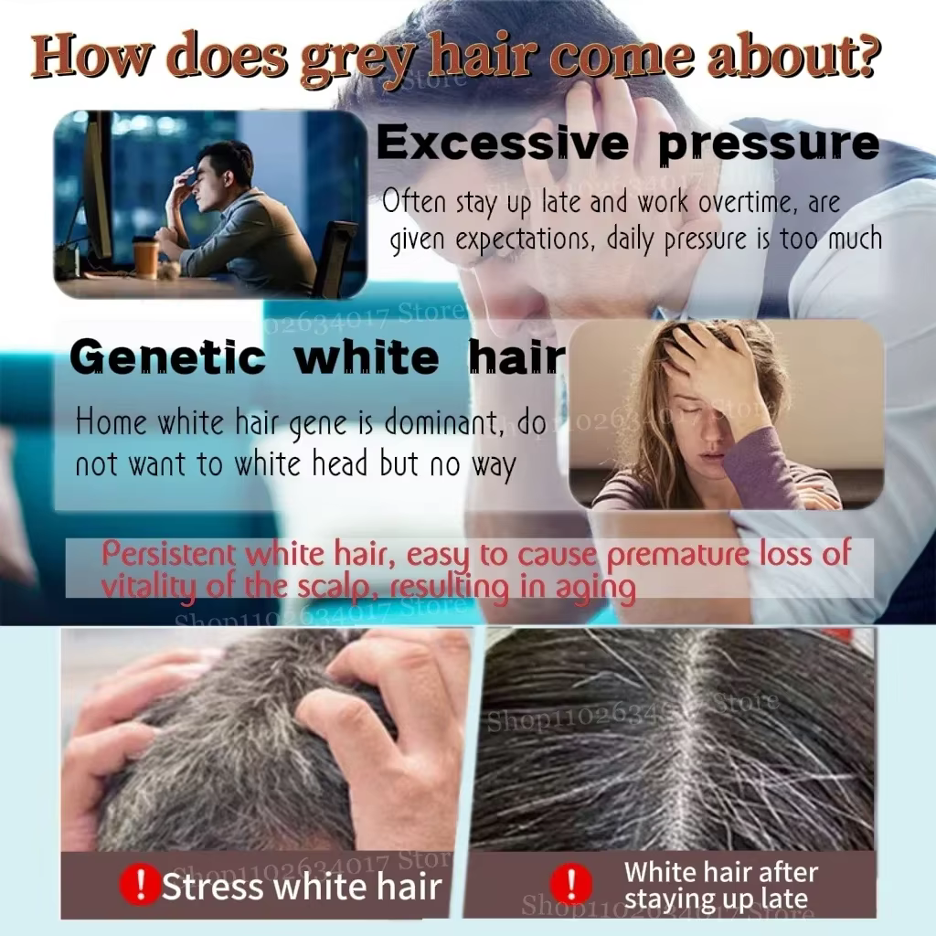 L'huile capillaire gris à noir réduit le greffage prématuré nourrit les follicules restaure le pigment