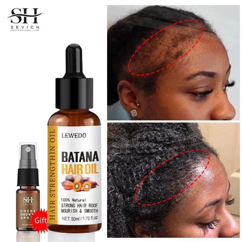 Sérum d'huile de Batana pour la croissance des cheveux