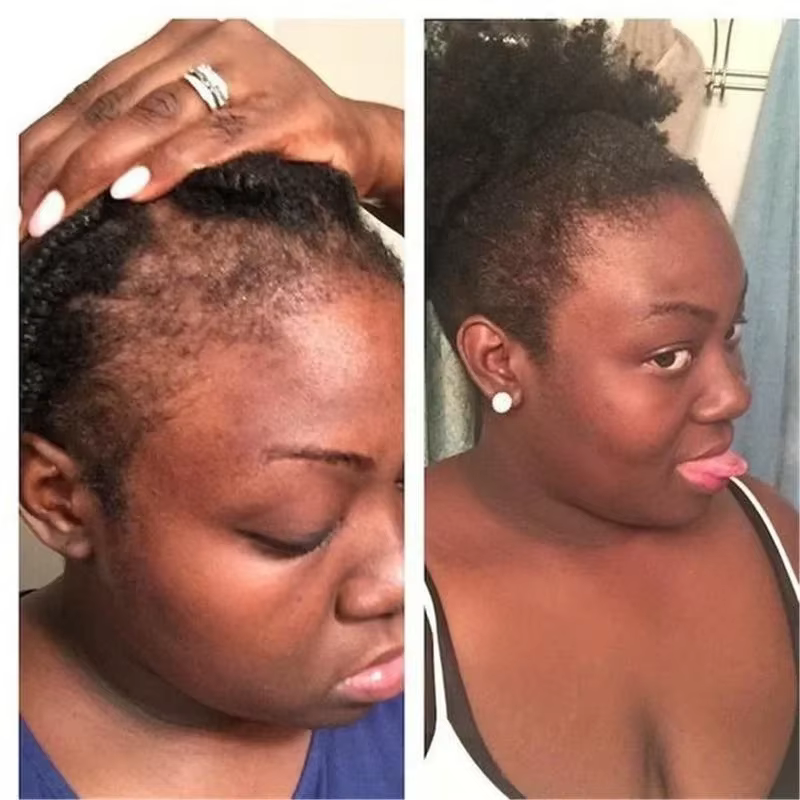 Shampoing cheveux pour une croissance rapide