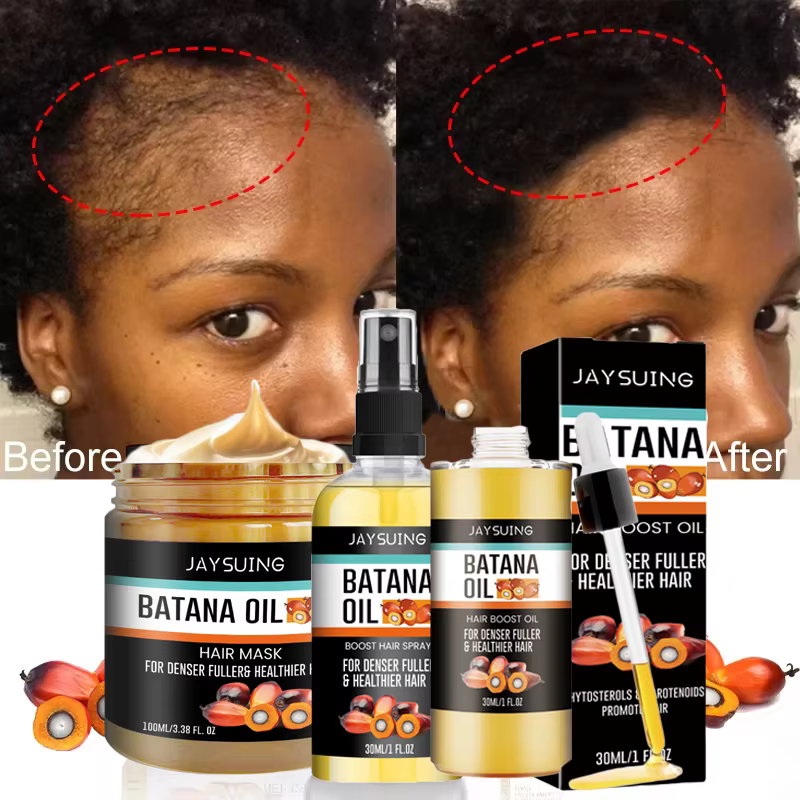 Kit de Croissance Capillaire Rapide : Huile de Batana