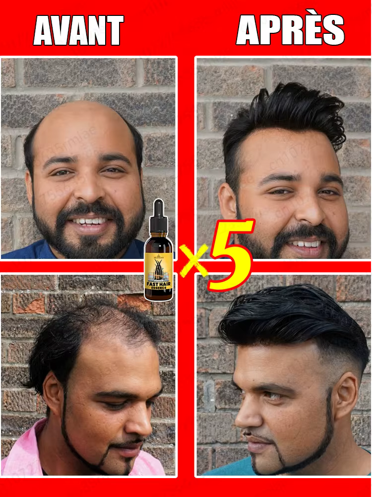 Faites-tu veux dire au revoir à la chute des cheveux? Nos produits peuvent pénétrer les follicules pileux et aider vos