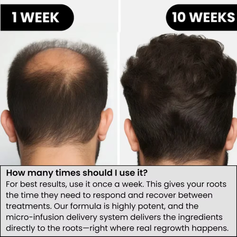 Sérum capillaire doux nourrit le cuir chevelu et soin pour les cheveux adoucissants Soins quotidiens