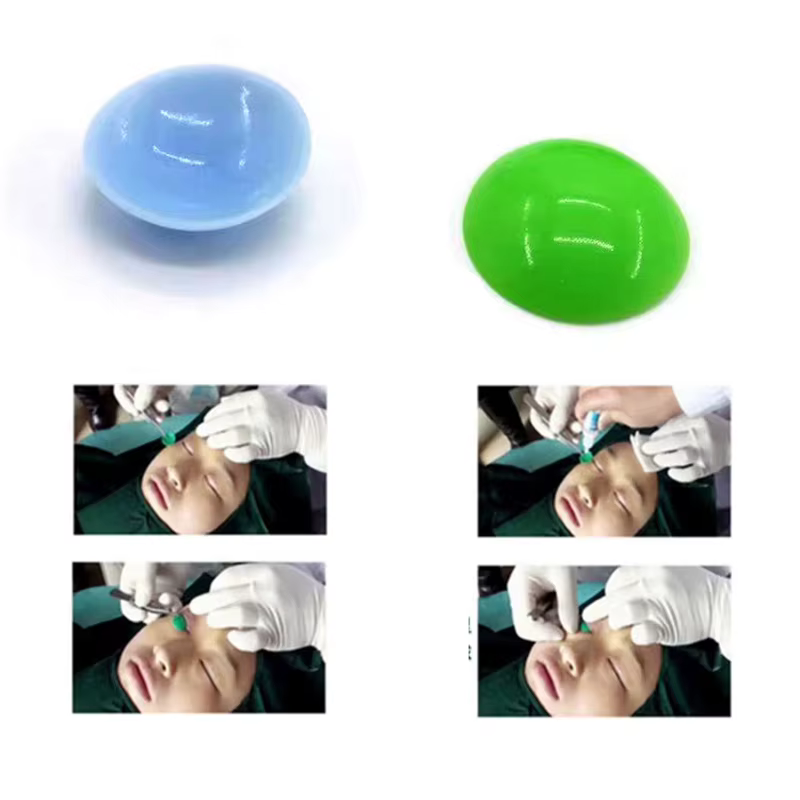 【Protège-œil en silicone souple avec absorbeur pour instruments de blepharoplastie et chirurgie ophtalmique】