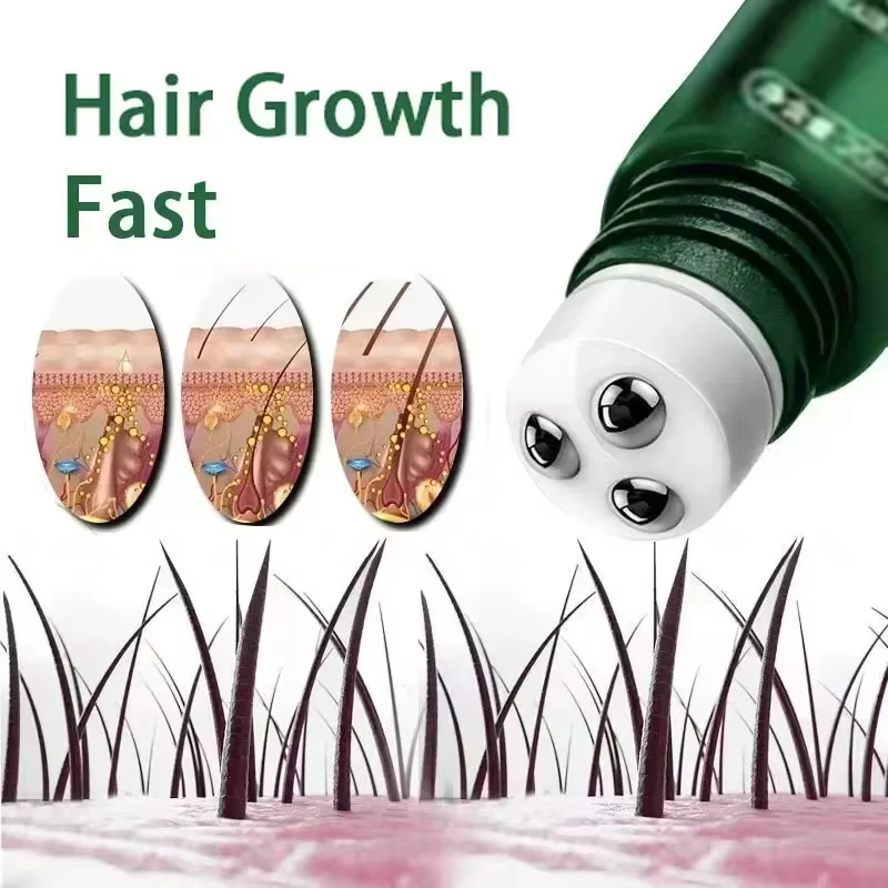 Soins du cuir chevelu huile de croissance des cheveux