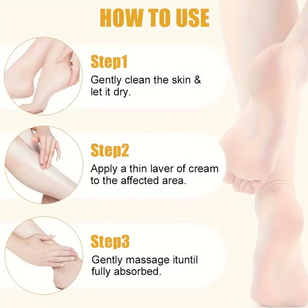 Crème pour les pieds à l'urée 40%, pour pieds secs et craquelés, talons, genoux, traitement réparateur des mains, crème hydratante pour les pieds, dissolvant de peau morte
