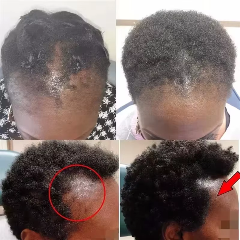 Sérum de croissance des cheveux 7 jours