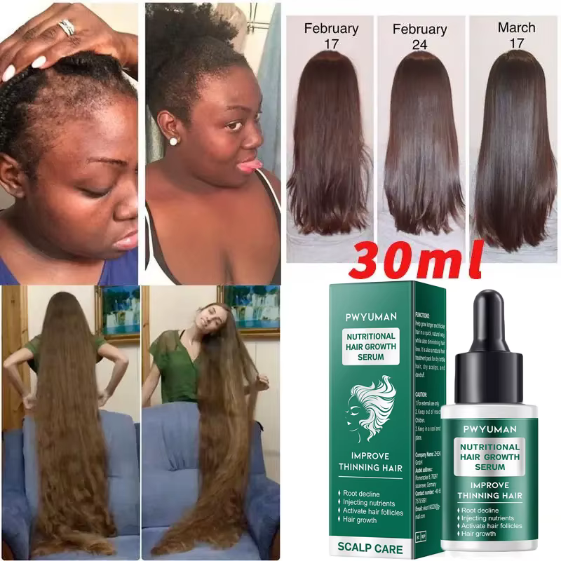 Sérum de croissance rapide des cheveux pour femmes et hommes