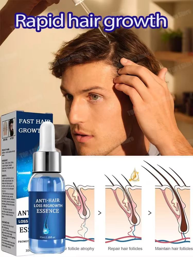 2 Sérum de croissance des cheveux et anti-chute de cheveux