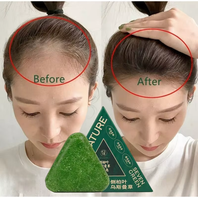 Arborvitae feuille shampooing savon fait à la main naturel à base de plantes soulagement des démangeaisons du cuir