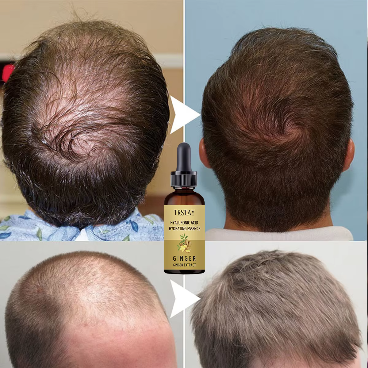 Sérum de croissance des cheveux