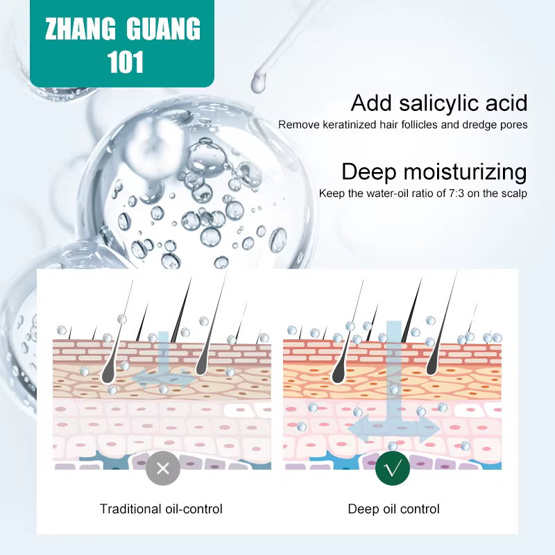 Zhang Guang 101 contrôle de l'huile apaisante cuir chevelu eau nettoyante équilibre