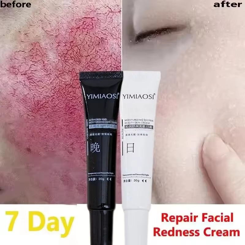 Crème réparatrice des rougeurs du visage coréenne, lotion hydratante et apaisante pour peaux sensibles, rosacée, hydratant jour et nuit pour améliorer la sécheresse