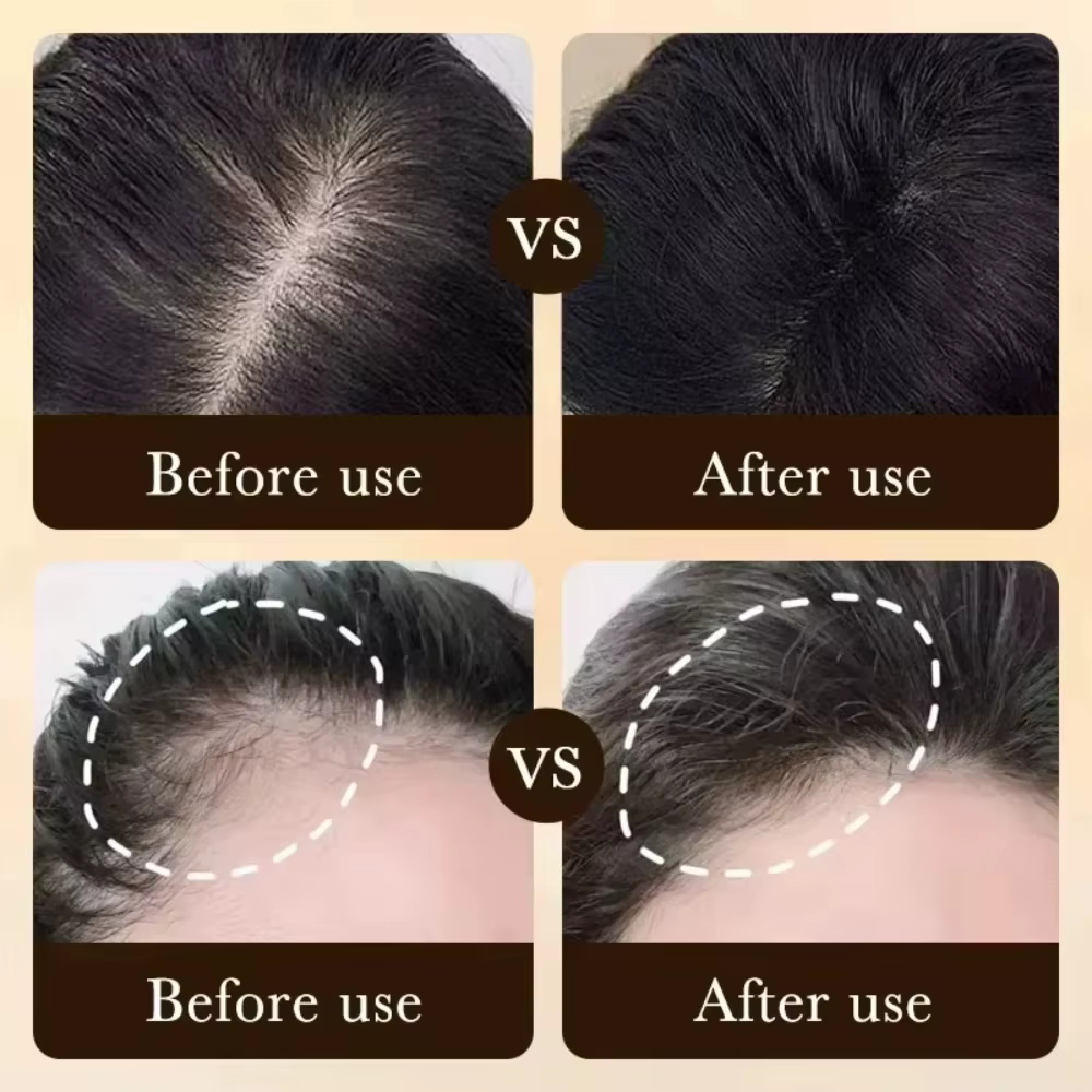 Essence de croissance et d'épaississement des cheveux